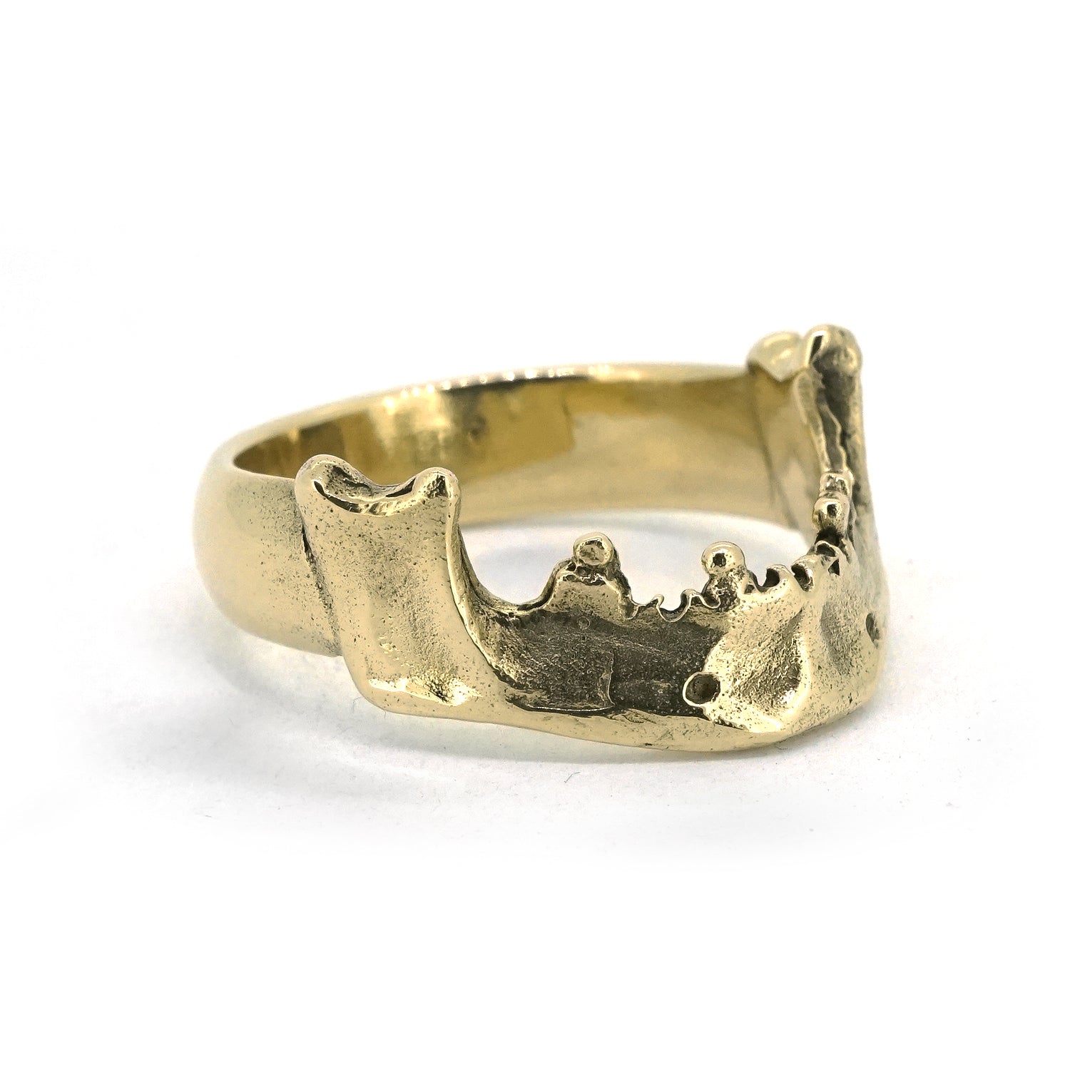MANDIBLE GOLD